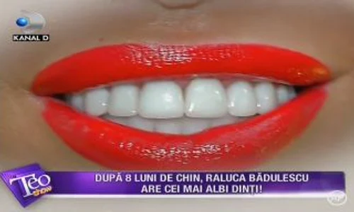 Raluca Bădulescu a investit mult timp și mulți bani pentru noul ei zâmbet jpeg