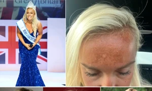 Fosta Miss Marea Britanie Jen Atkins și afecțiunea cauzată de bronzantul nazal Colaj YouTube This Morning jpg