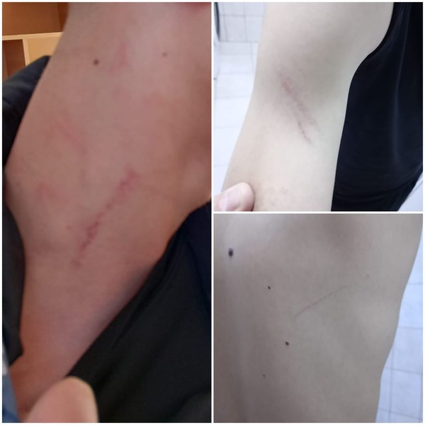 Copil agresat într-un centru de tip familial, de o asistentă medicală: „Mi-a băgat mâna în gât, mi-a dat cu pumnii“