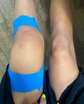 Roxana a avut lichid la unul dintre genunchi foto Instagram