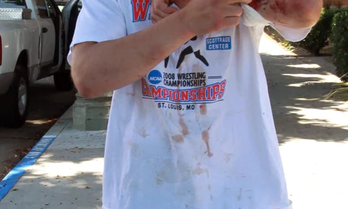 Weston Cage Is A Bloody Mess After Battle With His Wife and A Night In Jail jpeg