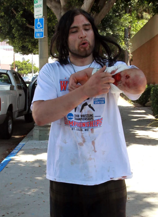 Weston Cage Is A Bloody Mess After Battle With His Wife and A Night In Jail jpeg