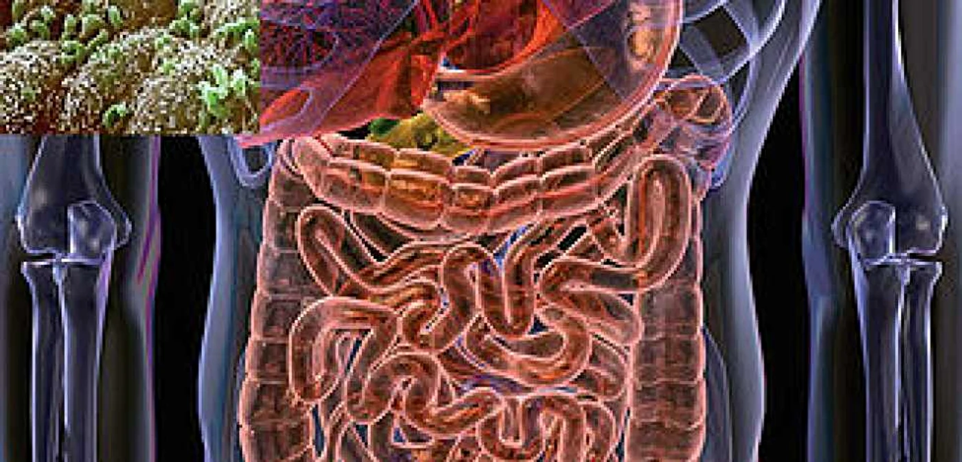 Transplantul de microbiotă intestinală, asociat obezităţii FOTO microbewiki.kenyon.edu