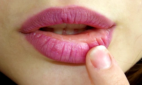 1 68146 original jpg jpeg