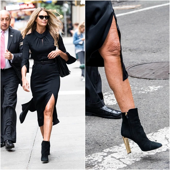 Elle Macpherson are pielea lăsată şi zbârcită pe picioare
