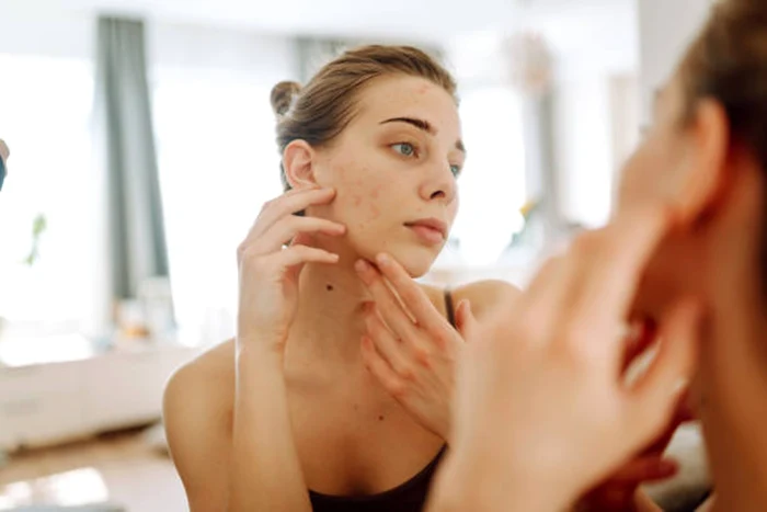 Unele suplimente pot afecta tenul / foto: IStock