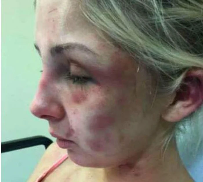 
    Kelsie a fost bătută crunt de iubitFoto: mirror.co.uk  