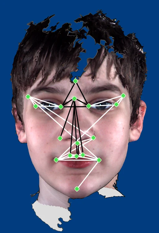 Geometria facială a unui copil autist