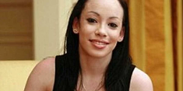 <b>Daily Mail</b>: O britanică de culoare devine albă, fiind afectată de vitiligo