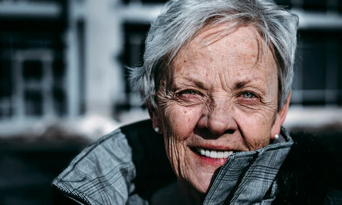 zambet dupa implanturi jpg