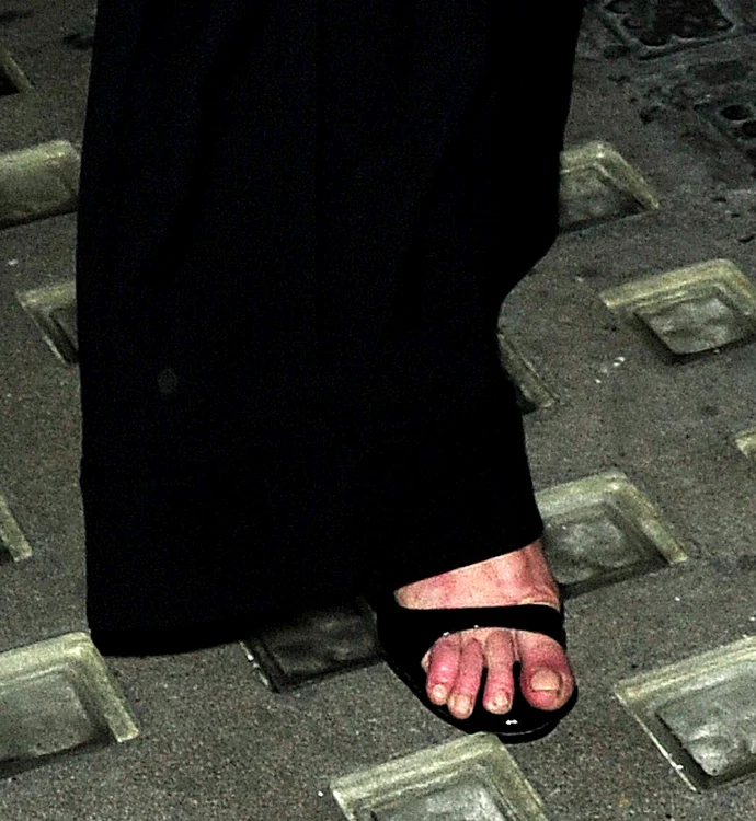 Kate Moss are nevoie urgentă de pedichiură