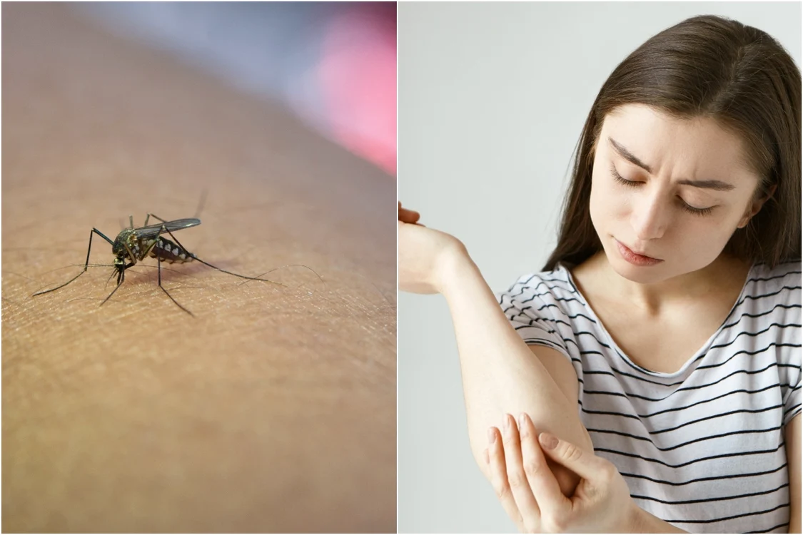 De ce nu e bine să ne scărpinăm după ce ne-a pișcat o insectă. Foto: magnific.com