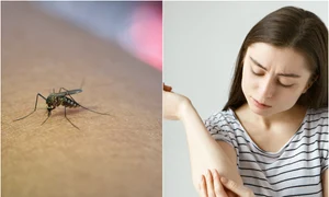 de ce nu e bine sa ne scarpinam jpg