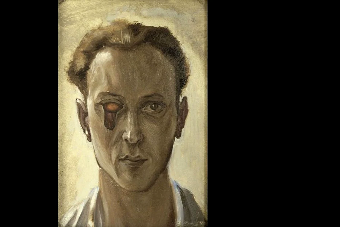 Victor Brauner – Ochiul pictorului  Accidentul din vara anului 1938 jpeg