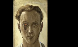 Victor Brauner – Ochiul pictorului  Accidentul din vara anului 1938 jpeg