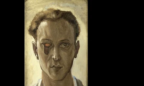 Victor Brauner – Ochiul pictorului Accidentul din vara anului 1938 jpeg
