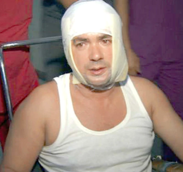 
    Victima a ajuns la spital cu arsuri  de gradul 1 şi 2 în zona capului  