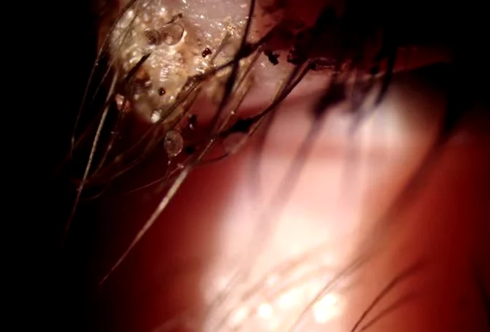 Împrumutul produselor cosmetice este neigienicfoto: captură video