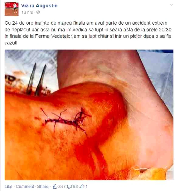 Viziru a promis că va lupta și într-un picior pentru finala "Ferma Vedetelor"