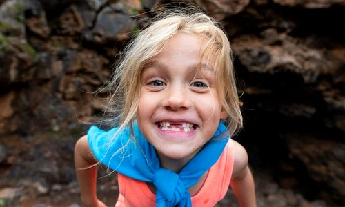 1 cariile dentare la copii jpg jpeg