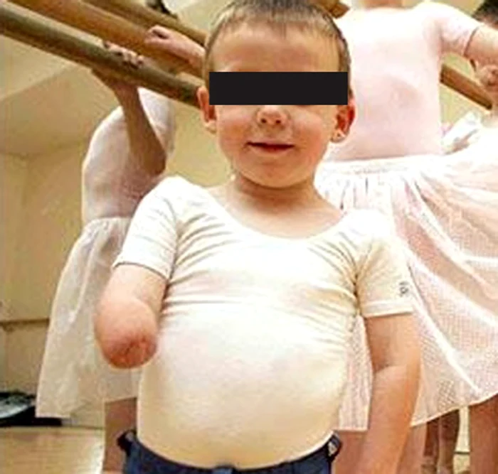 
    Medicii sunt surprinşi de faptul că băieţelul a supravieţuit sângerii excesive  
