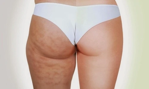 1 70067 original jpg jpeg