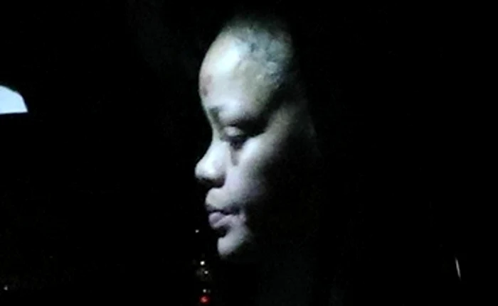 Are un hematom pe frunte, un ochi vânăt şi faţa tumefiată