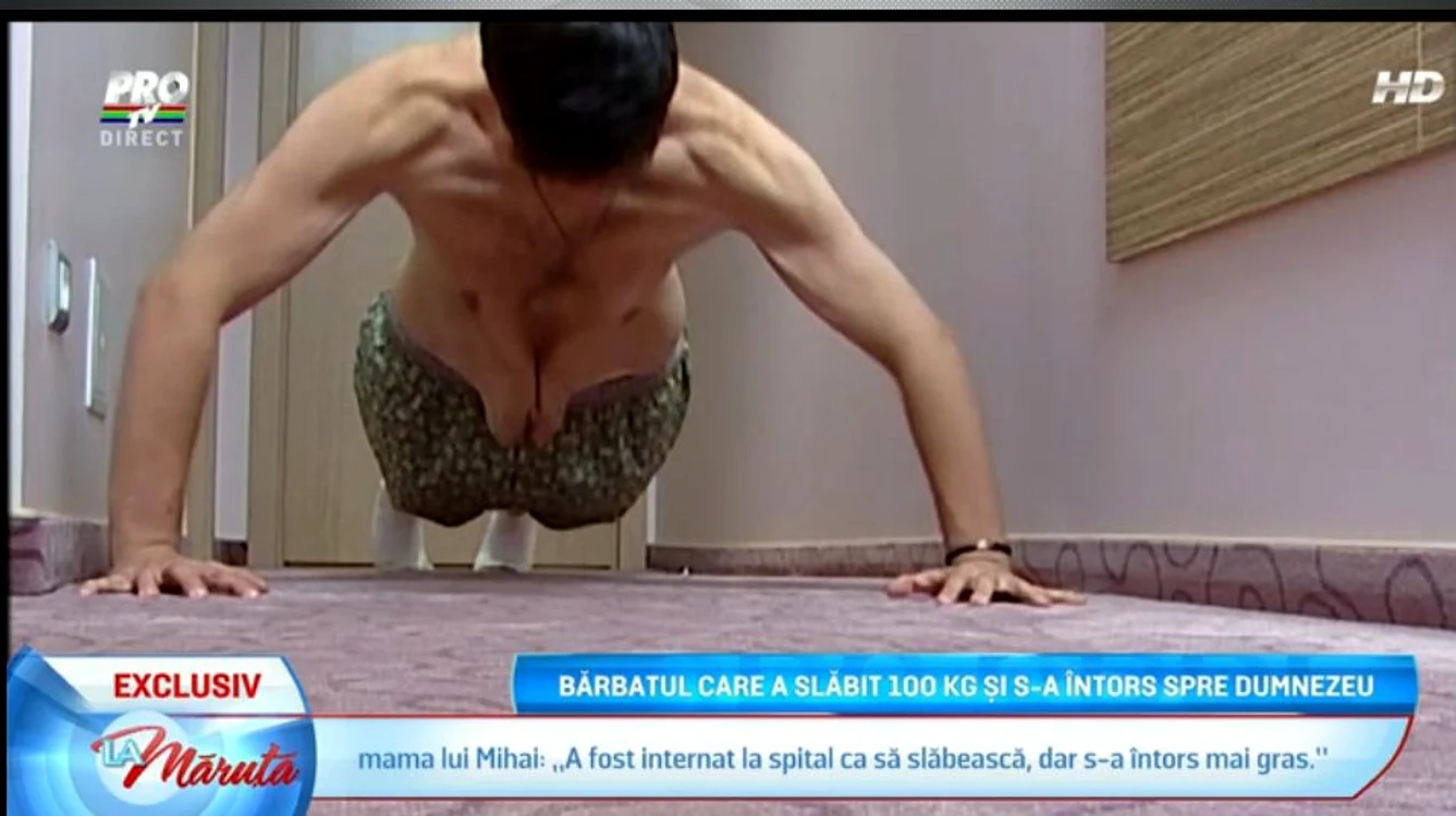Pielea bărbatului era foarte lăsată, înainte de a ajune pe mâinile medicilor