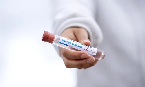 test tube 5065426 1920 jpeg