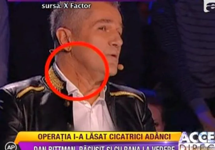 Dan Bittman, la emisiunea «X Factor»