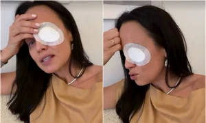 andreea raicu ochi bandajat jpg