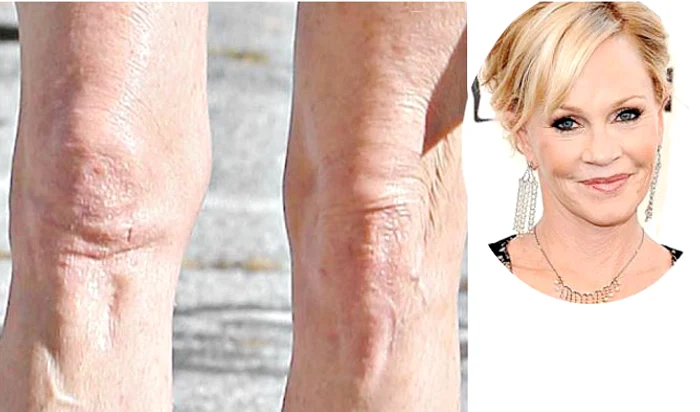 Melanie Griffith