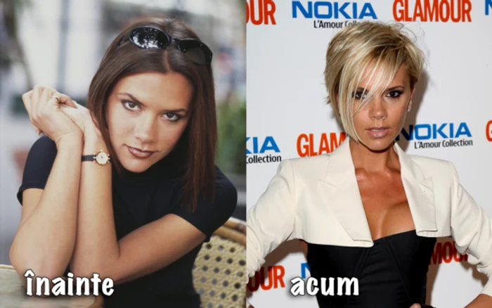 Mickey Rourke are fața înghețată, nu mai seamănă cu chipul său frumos din anii 1980foto: GettyImages