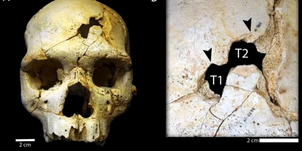 Craniul primei persoane omorâte din istorie. FOTO IBTimes UK