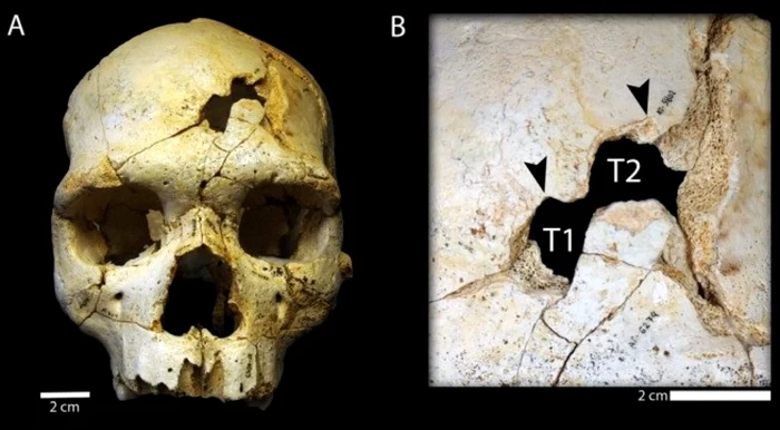 Craniul primei persoane omorâte din istorie. FOTO IBTimes UK