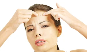 femeie alunita1221212 jpeg