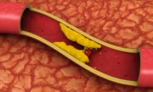 1 73318 original jpg jpeg