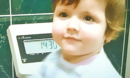 Micuţa ajunsă acum la 14 kg va învăţa să vorbească şi va face recuperare la un centru de plasament din Bârlad  jpeg