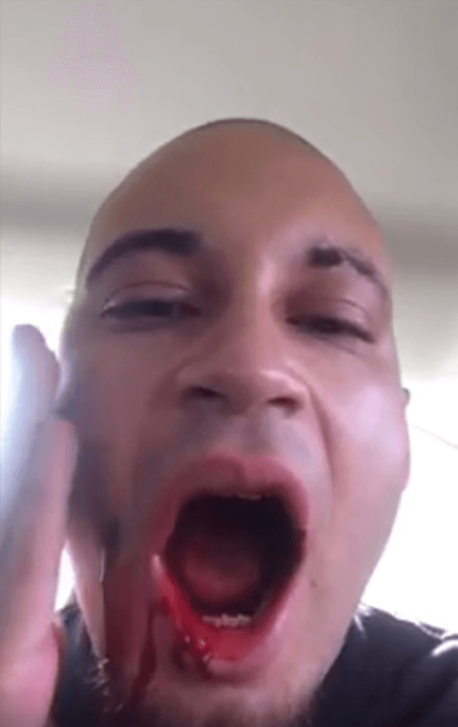 Content image