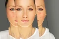Rozacee  Evita cosmeticele cu aceste ingrediente  Sursa foto shutterstock 2175334735 jpg