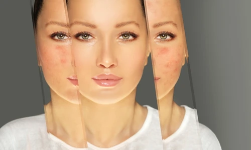 Rozacee  Evita cosmeticele cu aceste ingrediente  Sursa foto shutterstock 2175334735 jpg