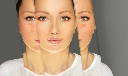 Rozacee Evita cosmeticele cu aceste ingrediente Sursa foto shutterstock 2175334735 jpg