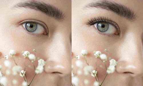 laminarea genelor (1) jpg