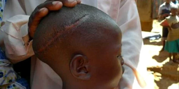 Copil mutilat in Uganda FOTO Jubile Campaign via BBC