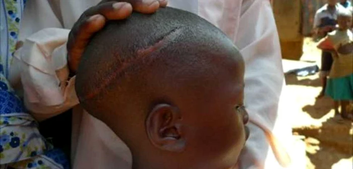 Copil mutilat în Uganda FOTO Jubile Campaign via BBC