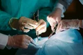 transplant operatie chirurgicala medici shutterstock 571823737 jpg