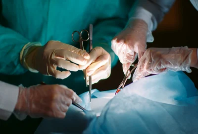 transplant operatie chirurgicala medici shutterstock 571823737 jpg