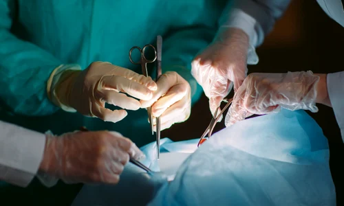 transplant operatie chirurgicala medici shutterstock 571823737 jpg