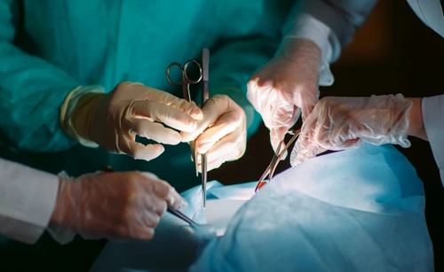 transplant operatie chirurgicala medici shutterstock 571823737 jpg