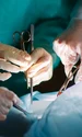 transplant operatie chirurgicala medici shutterstock 571823737 jpg